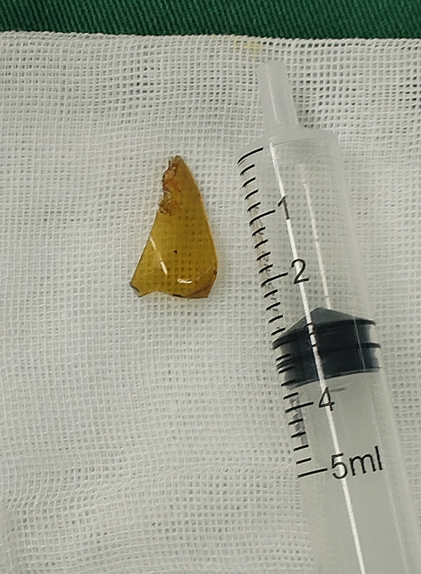 eb10de189ff57b26f3a0ad9a99848acf.jpeg eb10de189ff57b26f3a0ad9a99848acf.jpeg